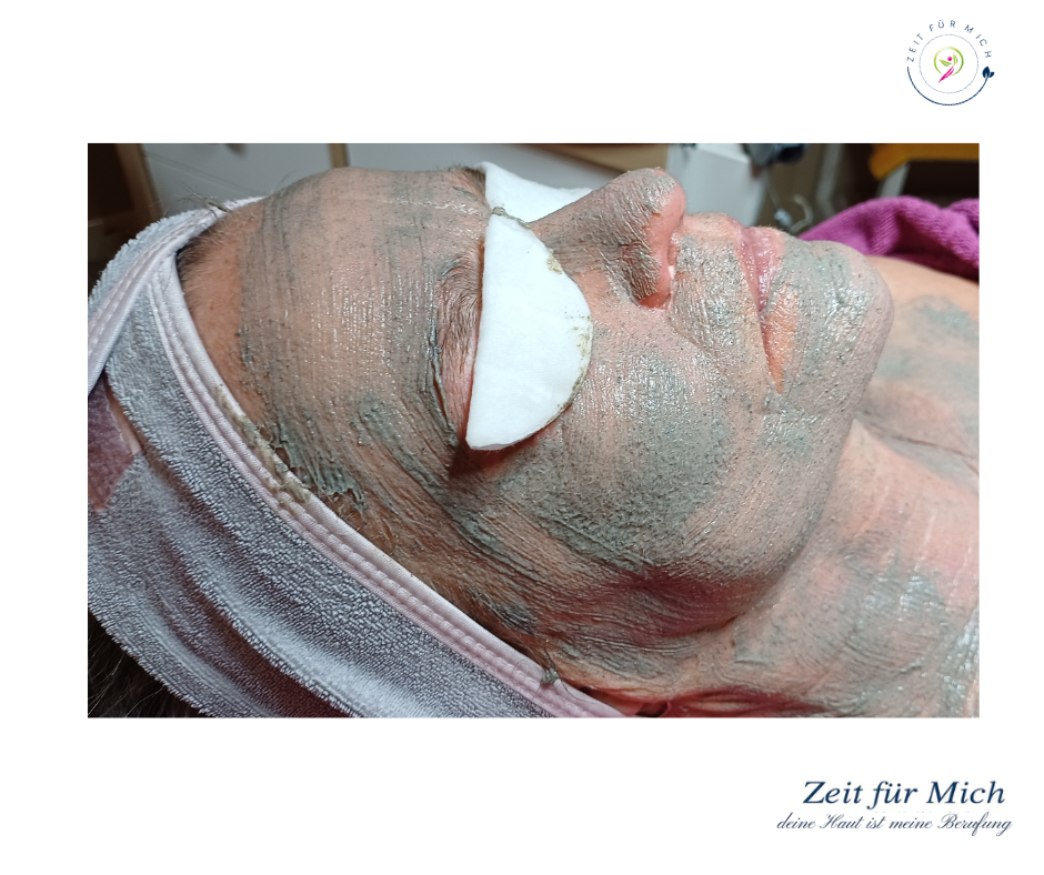 Bio Micr Needling Behandlung Kürnach Claudia Morczinek